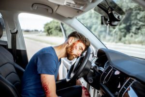 injured man with a broken head and bleeding wounds sitting on the driver seat
